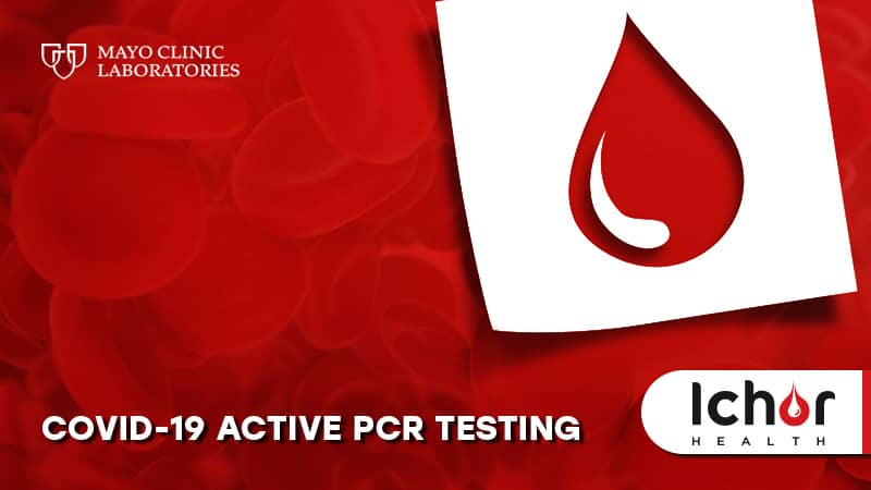 COVID-19 Active PCR Testing