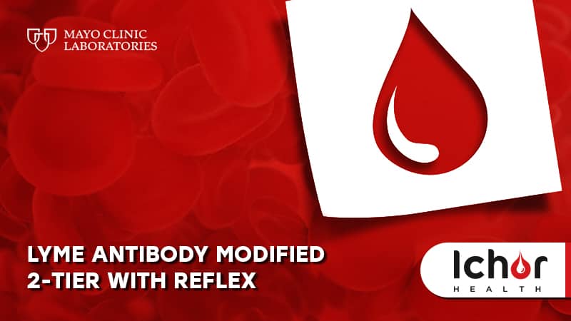 Lyme Antibody Modified 2-Tier with Reflex