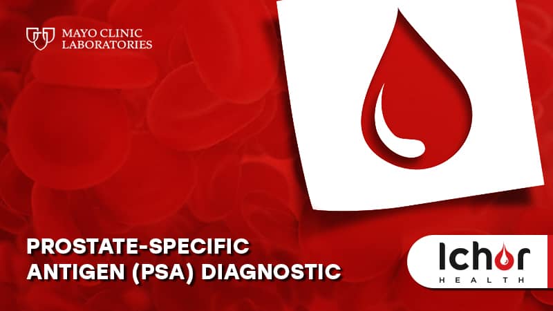 Prostate-Specific Antigen Serum Test | PSA Blood Test | Private Lab