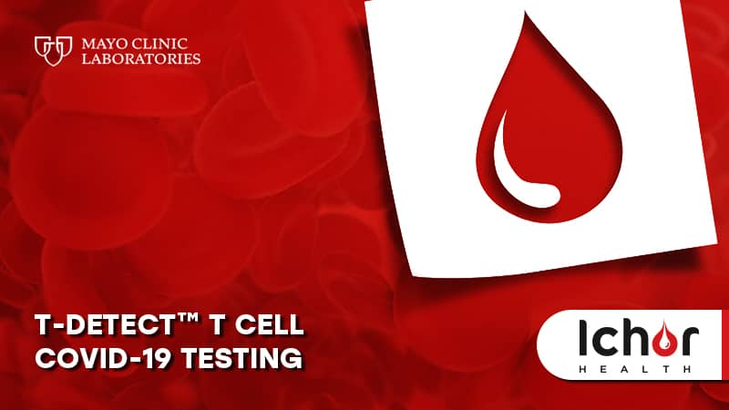 T-Detectâ¢ T Cell COVID-19 Testing
