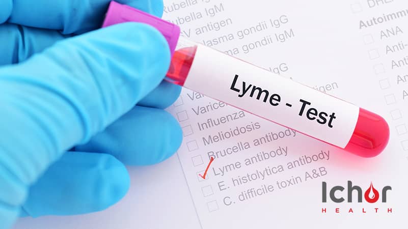 Lyme Disease Testing: May Newsletter