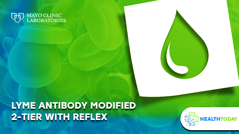 Lyme Antibody Modified 2-Tier with Reflex