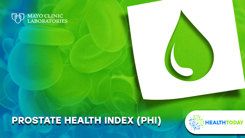 Prostate Health Index Test Prostate Cancer Test Private Lab 