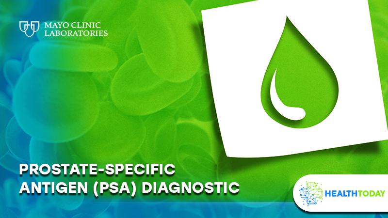 Prostate-Specific Antigen (PSA) Diagnostic