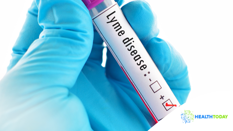 Lyme Disease Testing: May Newsletter